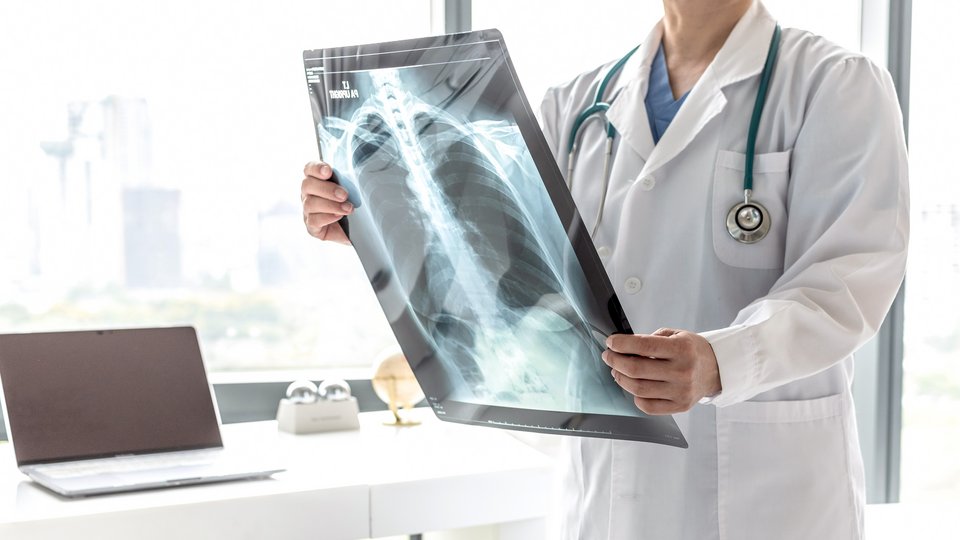 Arzt betrachtet Röntgenbild